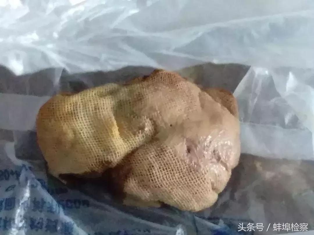 做了人流几天后腹痛还排出异物,女生流产手术后小肚子大