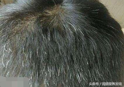 国颐堂养发馆防脱生发效果怎么样,国颐堂养发骗局揭秘