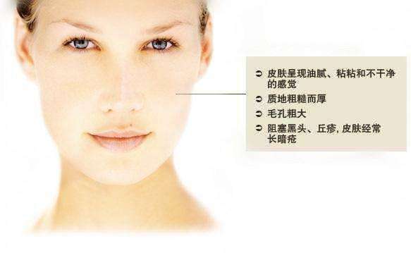 控油祛痘保湿补水的护肤品,面部控油最有效的方法