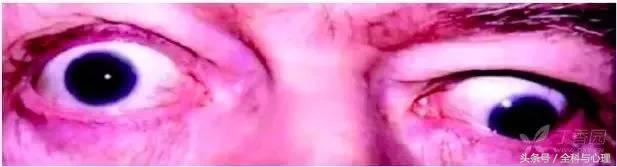 周围性眩晕症吃什么药,周围性眩晕与中枢性眩晕吃什么药