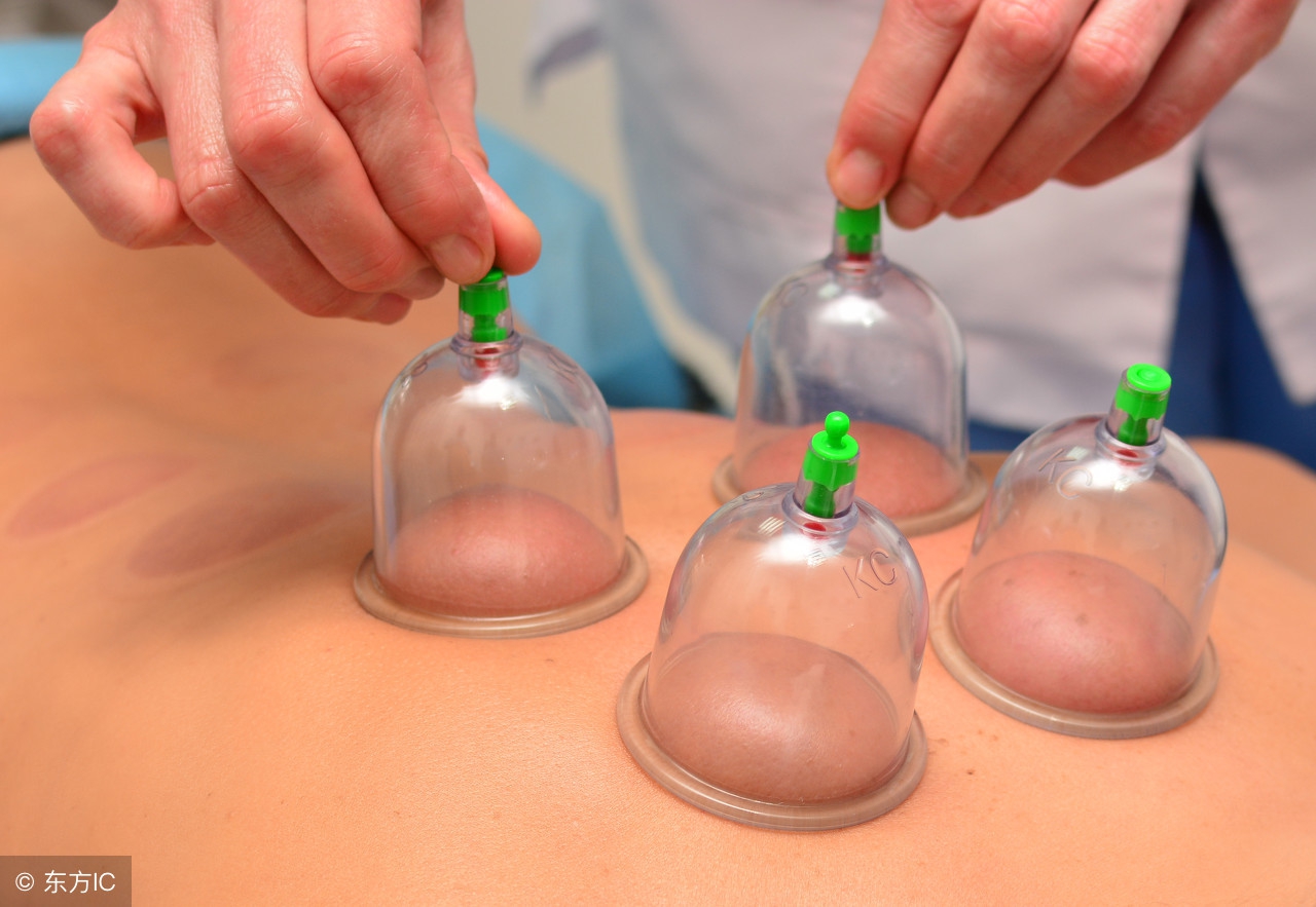 中医拔罐需要注意什么,中医拔罐的正确操作步骤