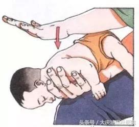 异物呛入气管的急救方法有哪三种,成人大蒜呛到鼻腔小妙招