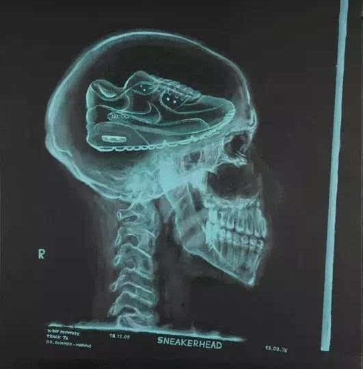 当你出现这4种症状的时候要警惕,出现这四个症状是好事还是坏事
