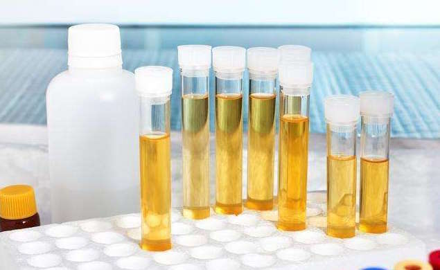 五个多月宝宝尿有点臭是怎么回事,晚上尿味重尿很骚臭是什么疾病