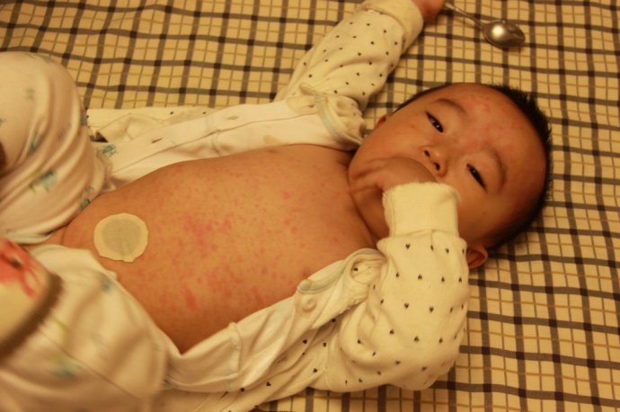 七个半月婴儿急疹症状及护理方法,婴儿急疹需要注意什么事项