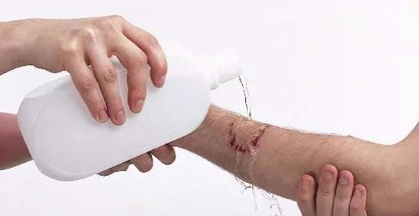 毒蛇咬伤需不需要截肢,被毒蛇咬后截肢会得昂髓炎吗