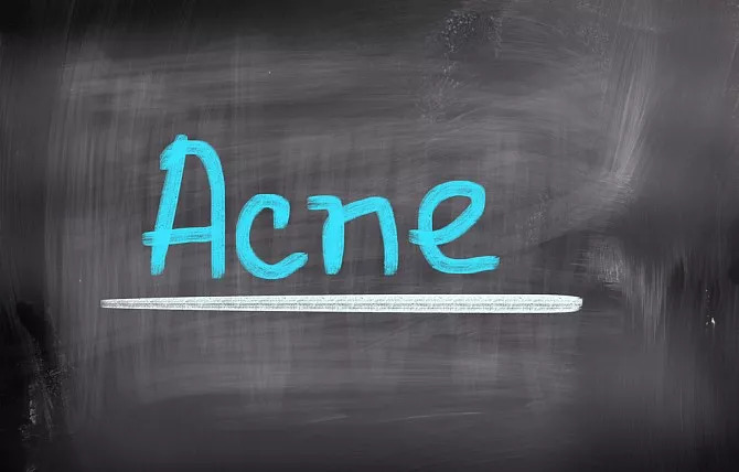 男孩子青春期脸上长痘痘怎样护理,脸上长痘痘皮肤很干