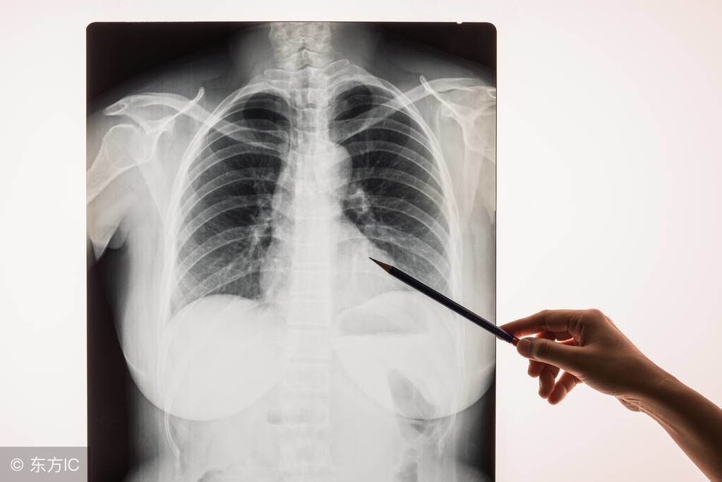 免疫治疗出现肺炎可以继续用药吗,支原体肺炎用药阿奇霉素多久有效