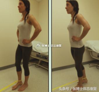 运动康复跑步膝盖疼,髂胫束摩擦综合征还能跑步吗