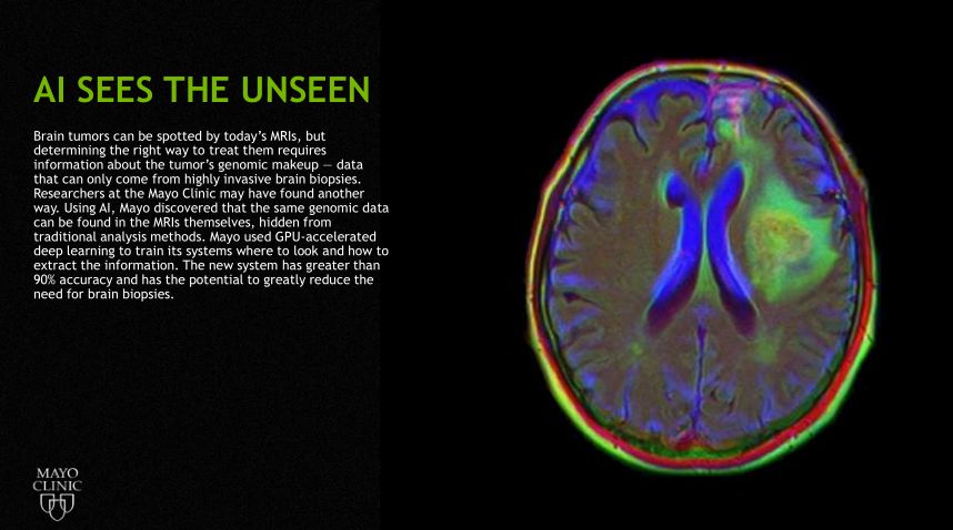 深度学习与医学影像,基于深度学习的医学影像分析