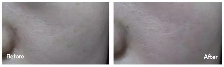 买了后悔的网红产品测评,十大网红产品个个是坑劝你别买