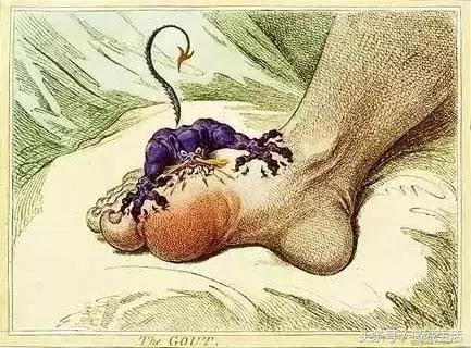 痛风久治不愈怎么办,痛风久治不愈就差在这一步上