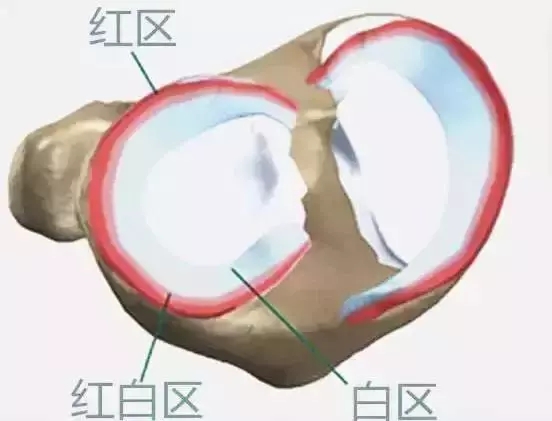半月板受过伤的球友训练常见误区,半月板损伤常见的二十个问题