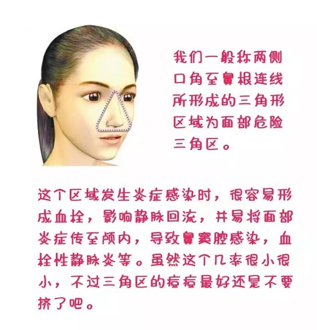 脸上痘痘涂药膏的正确方法,痘痘在脸上如何用祛痘贴