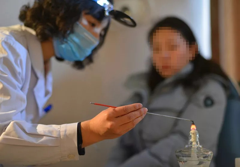 中医扁桃体烙法痛吗,中医烙法治疗扁桃体靠谱吗