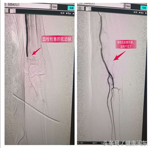 闂戒笢鍖婚櫌鏁戝姪,闂戒笢鍖婚櫌鍖荤枟浜嬫晠