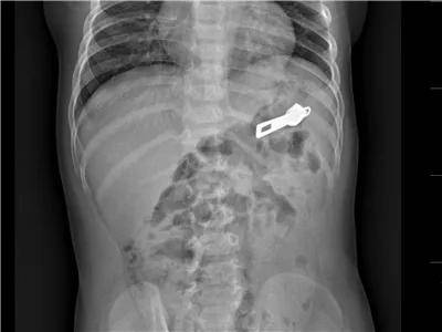 一些让人毛骨悚然拍到的照片,六个令人毛骨悚然的影像