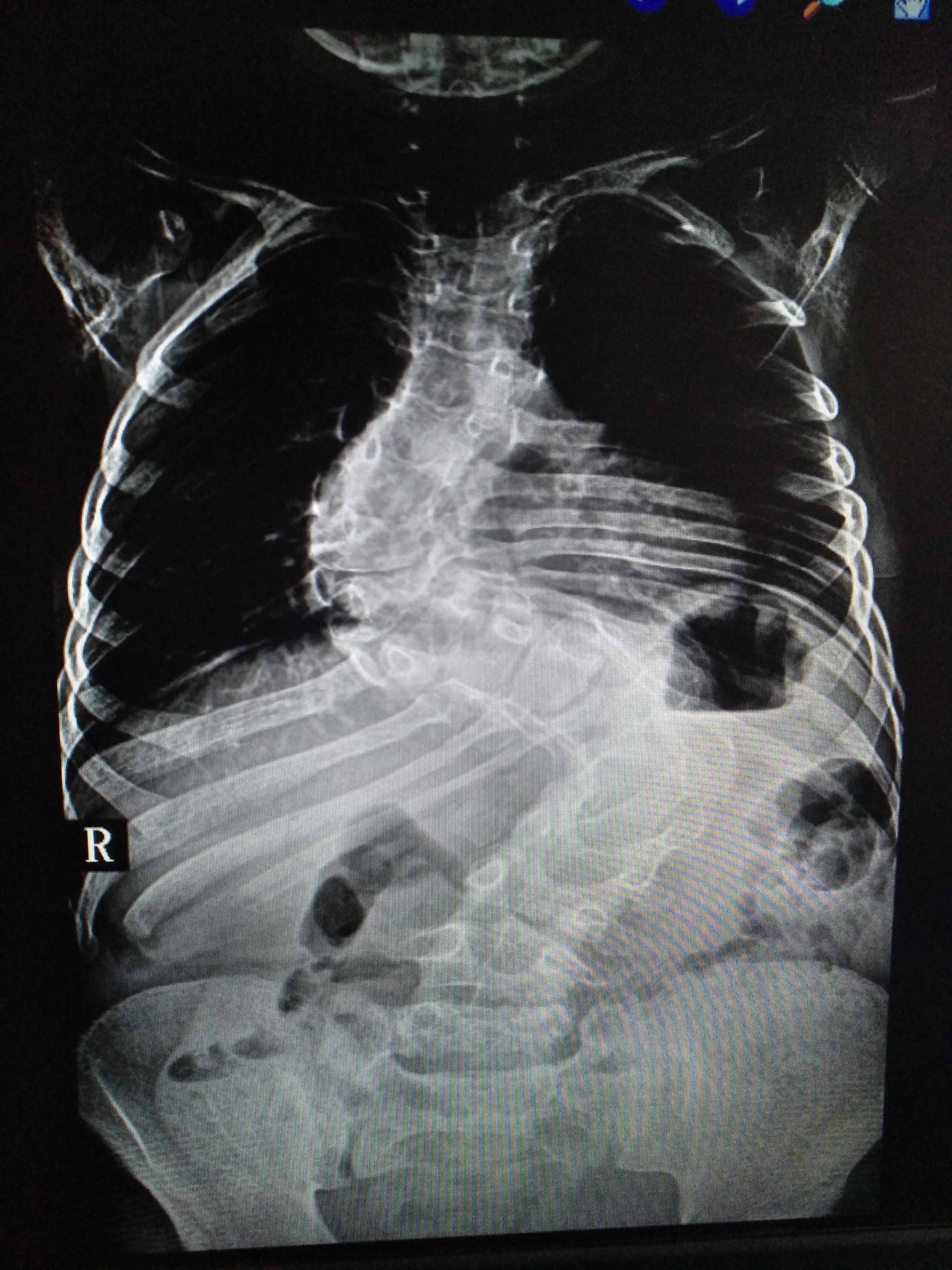 骨科专家帮扶,骨科下乡帮扶预期目标