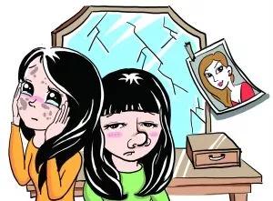 鼻中隔偏曲需要手术治疗吗,鼻中隔偏曲手术引起空鼻症