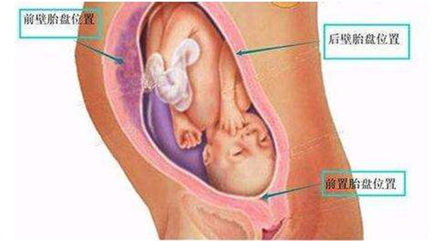 怀孕五月份的宝宝应该注意什么,怀孕五个月宝宝注意事项