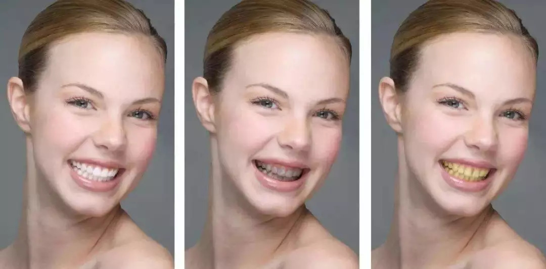 公认去牙黄最好的牙膏老爸评测,去牙渍去口气的牙膏测评