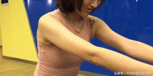 翼状肩胛骨矫正最快的方法,翼状蝴蝶骨矫正