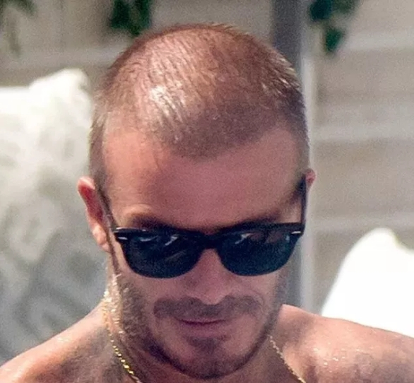 大v小贝,小贝秃头