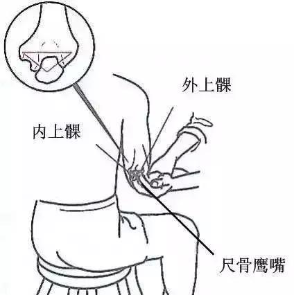 胳膊肘疼是怎么回事网球肘,老年胳膊肘疼怎么回事