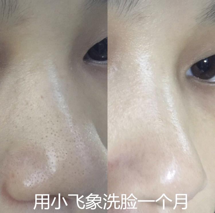 luna洁面仪德国版,luna洁面仪日版和韩版哪个好