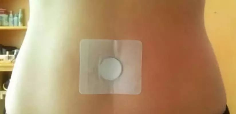 肚脐补元气最快的方法,健康的肚脐长什么样