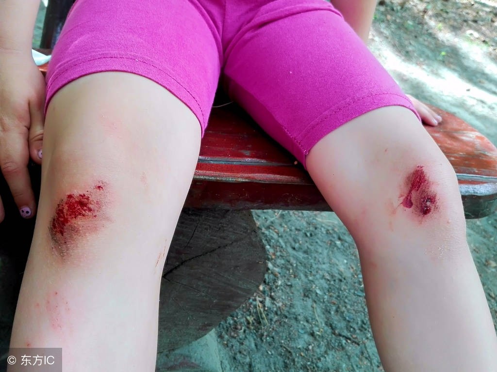 孩子不小心掉了一直流血要流几天,小孩不小心碰到嘴出血