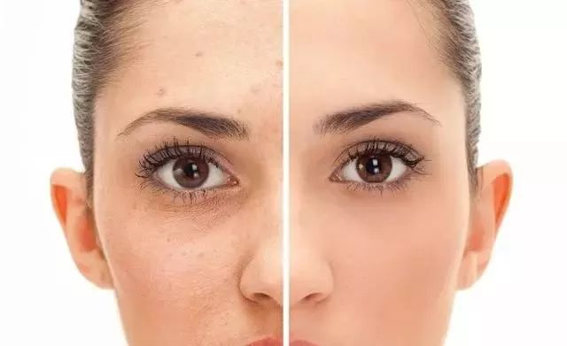 脸上污垢,脸上的脏东西真能清理出来吗