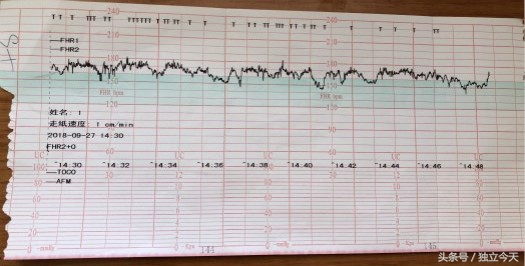34周胎心监测胎动期间胎心率不高,33周胎心监测显示有宫缩