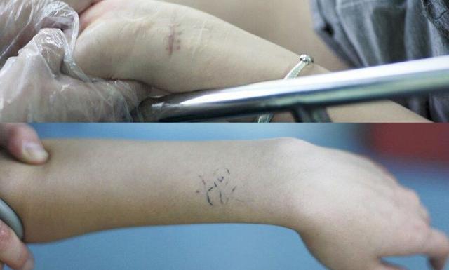 平时如何避孕,平时大家怎么避孕