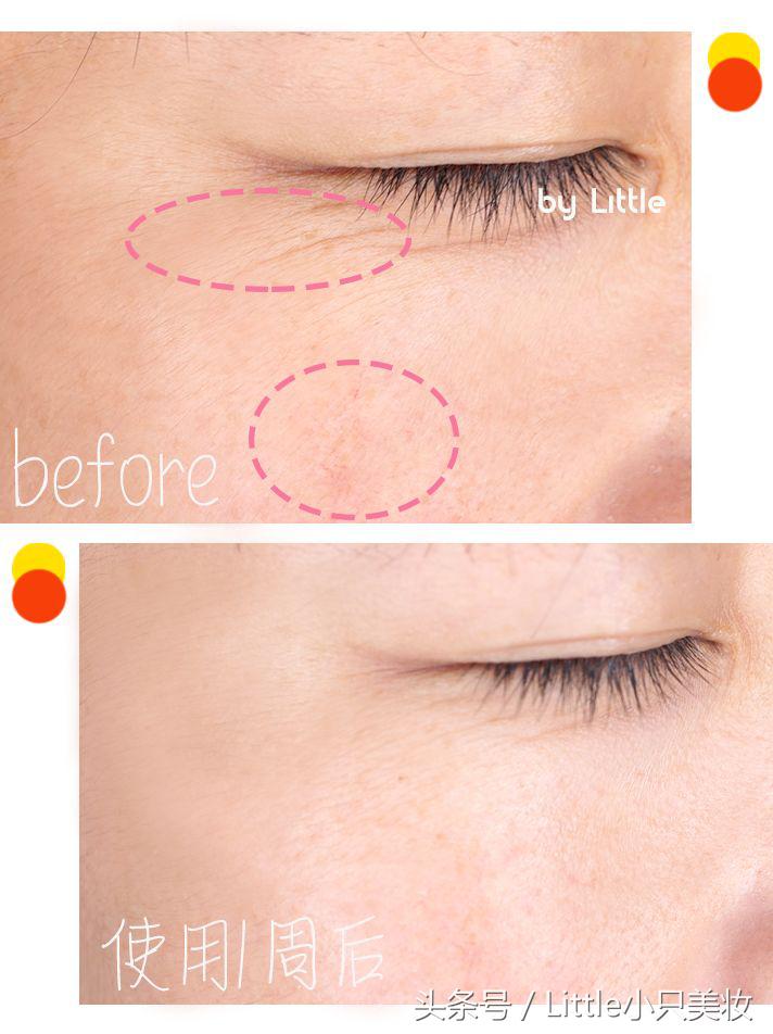 皮肤混合性偏干长痘护肤品推荐,换季油脸变干痘痘严重推荐护肤品