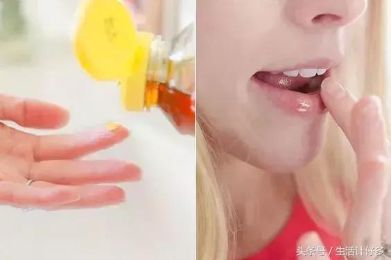 嘴唇开裂让你丑10倍，不花1分钱一招立刻变水润！