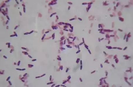 枯草芽孢杆菌不能和哪些肥料使用,枯草芽孢杆菌不能和什么药使用