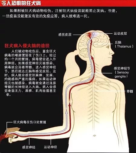 如果得了狂犬病一般会怎么发作,收养流浪狗不幸感染狂犬病怎么办