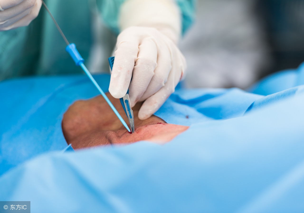 羊水穿刺的注意事项有哪些,羊水穿刺注意事项有哪些