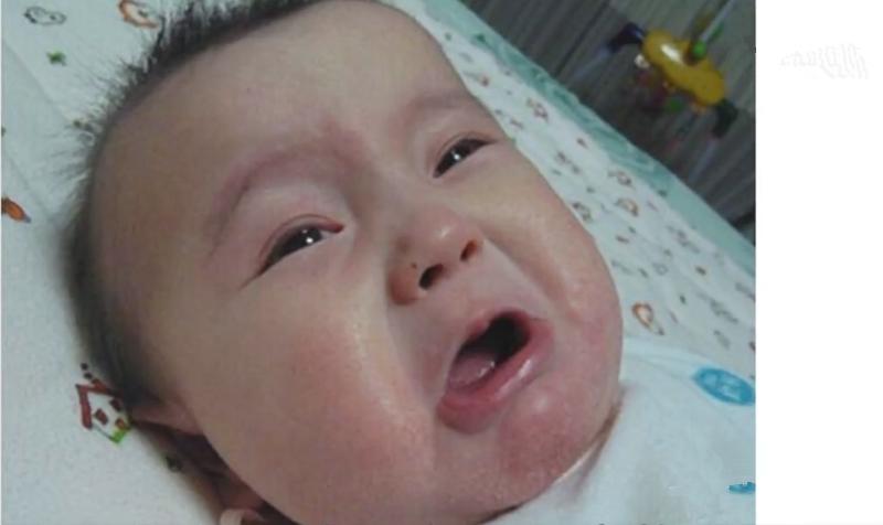 宝宝湿疹妈妈饮食应该注意什么,孩子长湿疹妈妈需要注意什么