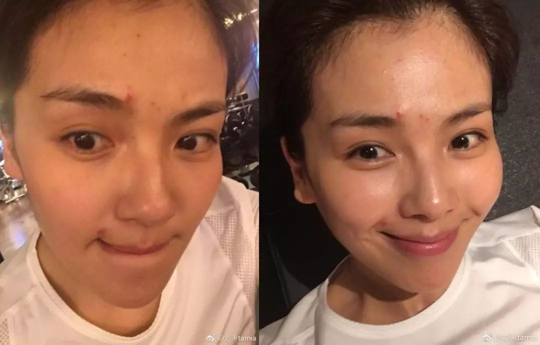 假期出行只有你晒黑了？刘雯、张馨予、林允给你皮肤急救方案