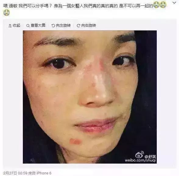 假期晒黑了怎么快速变白？试试刘雯、张馨予、林允的皮肤急救方案