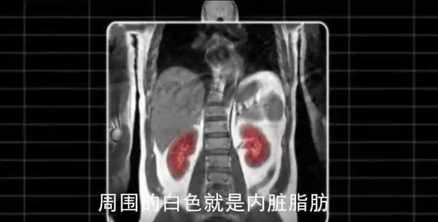 居然真有这么简单的减肥方法,最权威的减肥方法要不要试试看