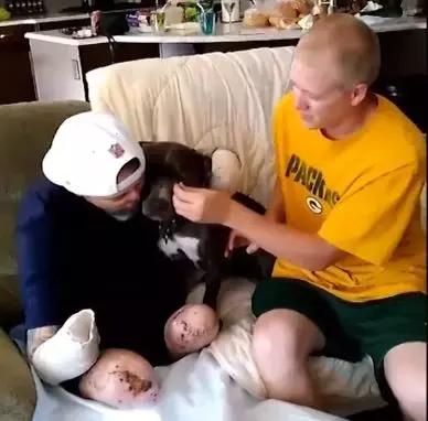 又一例！他严重感染四肢被截，竟只因被狗狗舔了一下……