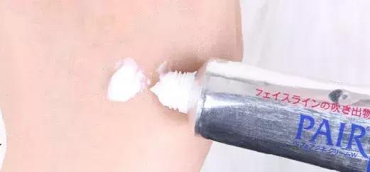 祛痘的神器,祛痘神器推荐额头起了很多痘