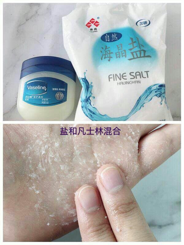 小孩黑头怎么去除最有效的方法,脸上黑头粉刺毛孔粗大怎么去除