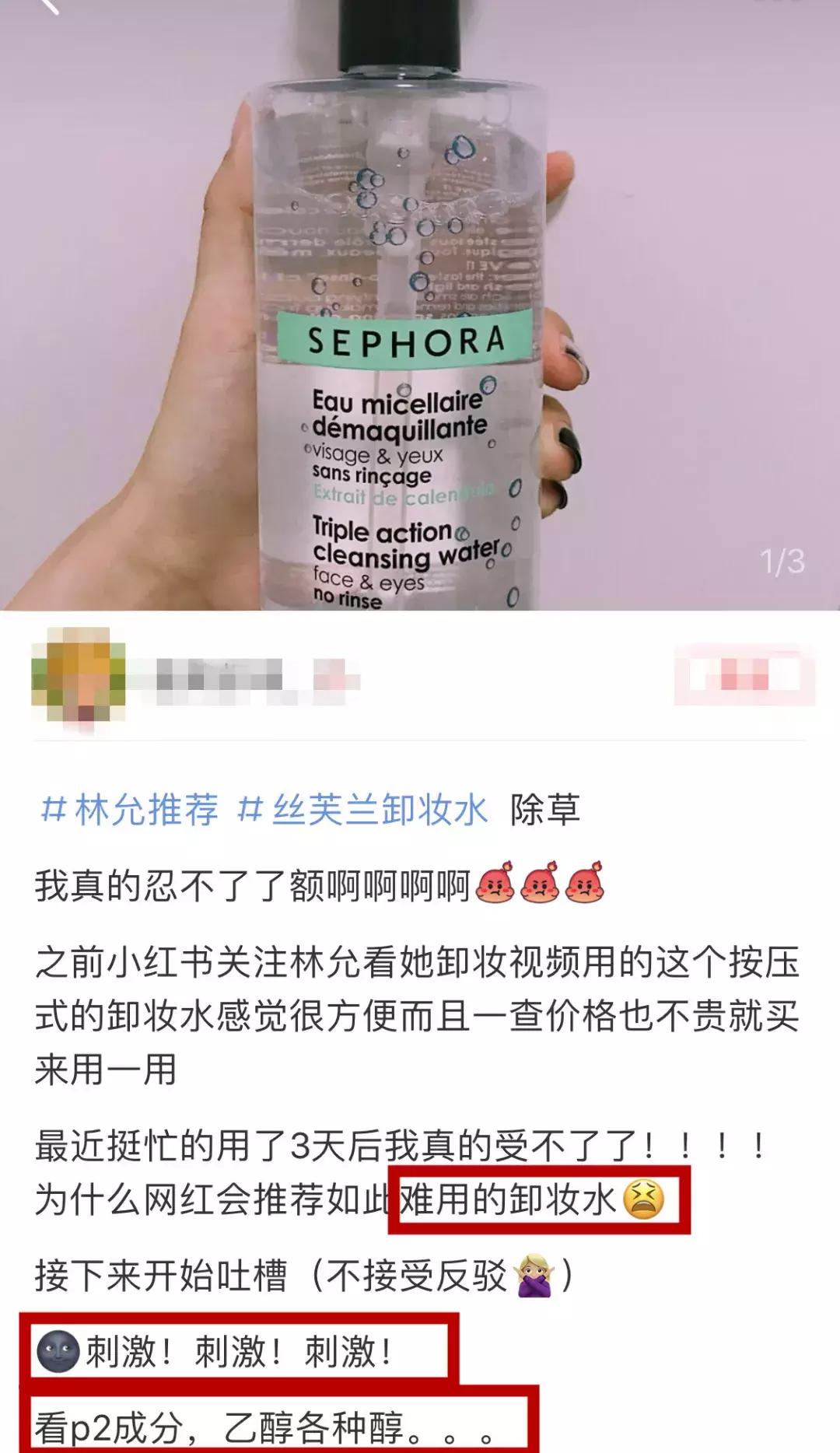 吴昕错误穿搭合集,林允吴昕面膜