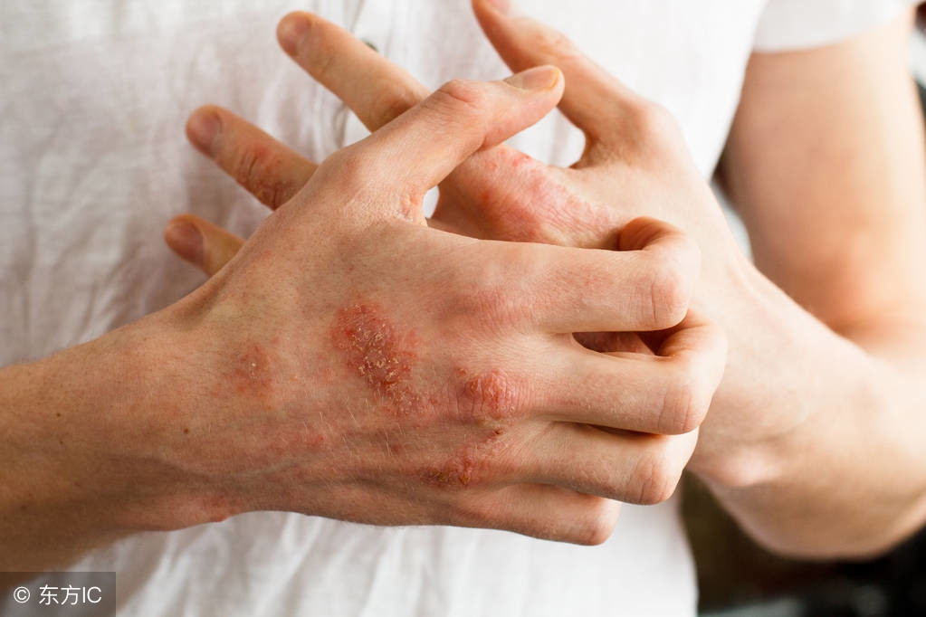 鐤剧梾鐨勮璇嗗拰娌绘剤鏂规硶,25涓柧鐥呮不鎰堝皬濡欐嫑