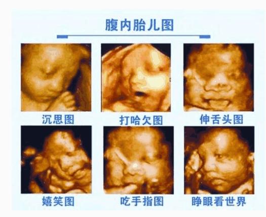 四维彩超宝宝不配合怎么办羊水少,四维产检宝宝不配合怎么办