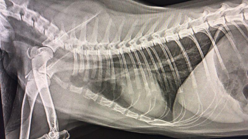 医院因为新冠造成误诊,医院误诊导致肺炎